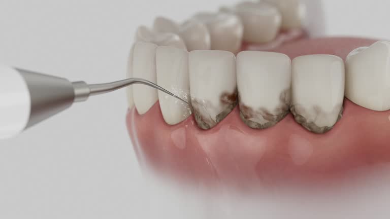 Reliable Wisdom Tooth Removal contractor in Meigs County County, OH by Dentist Open Now